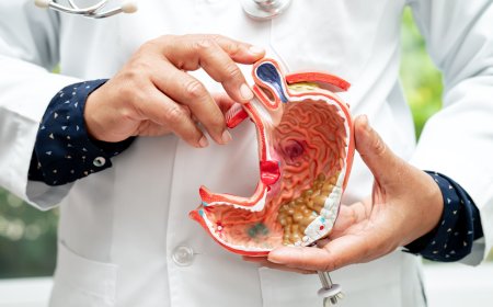 Gastrit: Belirtileri, Nedenleri ve Tedavi Yöntemleri