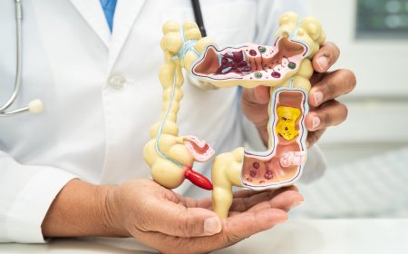 Crohn Hastalığı Nedir? Belirtileri, Nedenleri ve Tedavi Yöntemleri