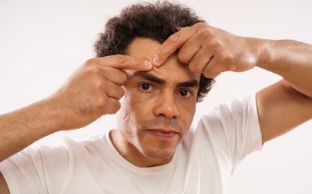 Şaşılık (Göz Kayması) Nedir?